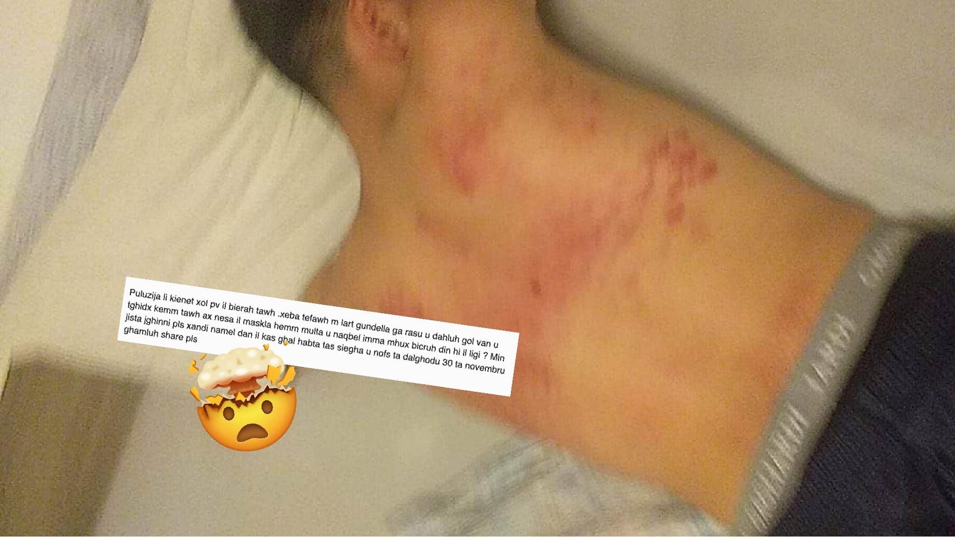 Mother posts photo graphic photo of son for alleged assault from police for not wearing mask