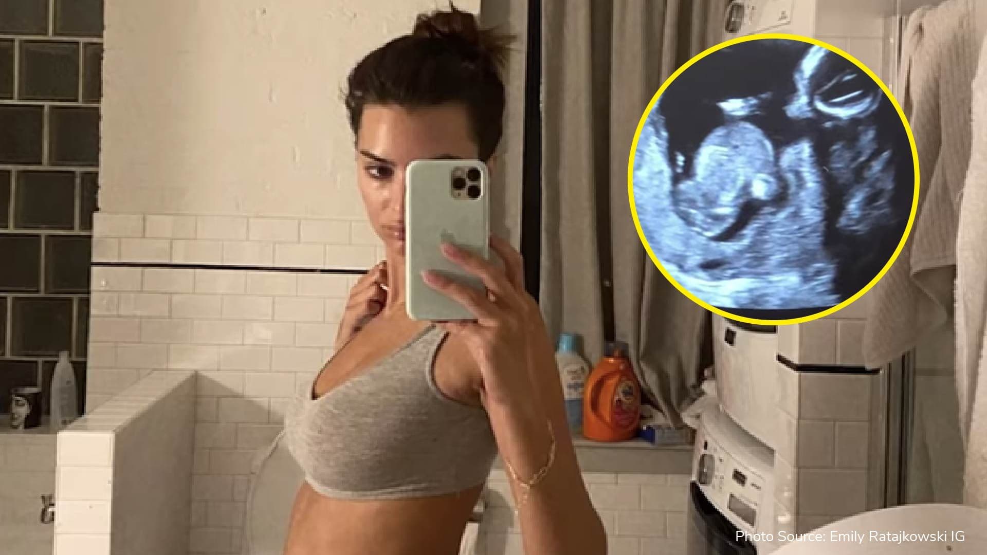Emily Ratajkowski is pregnant and here’s why she won’t tell us the gender