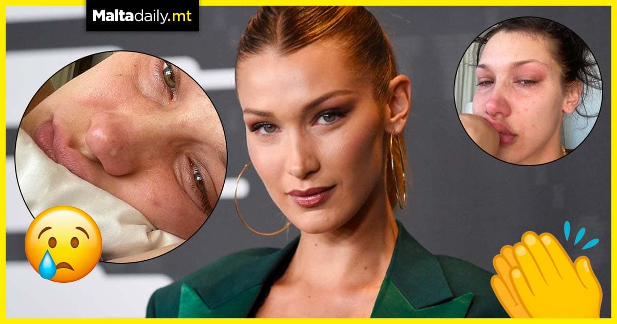 ‘I’ve had breakdowns and burnouts’ – Bella Hadid opens up about mental health