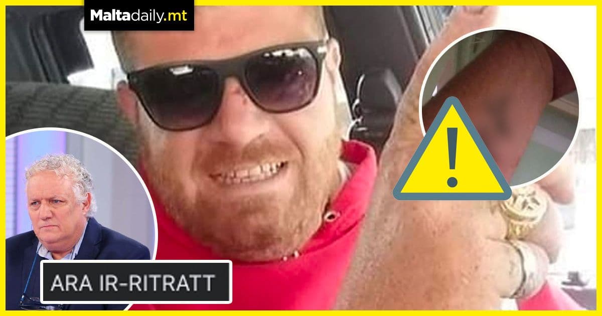 Peppi Azzopardi releases graphic self-harm images of late Colin Galea