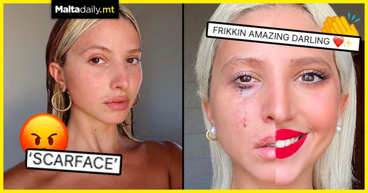 Sarah Zerafa opens up about social media trolling in empowering post