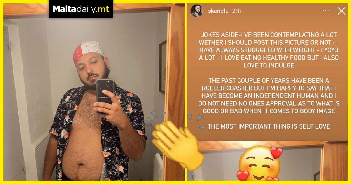 Marco Parascandalo’s self love post is what we all need right now