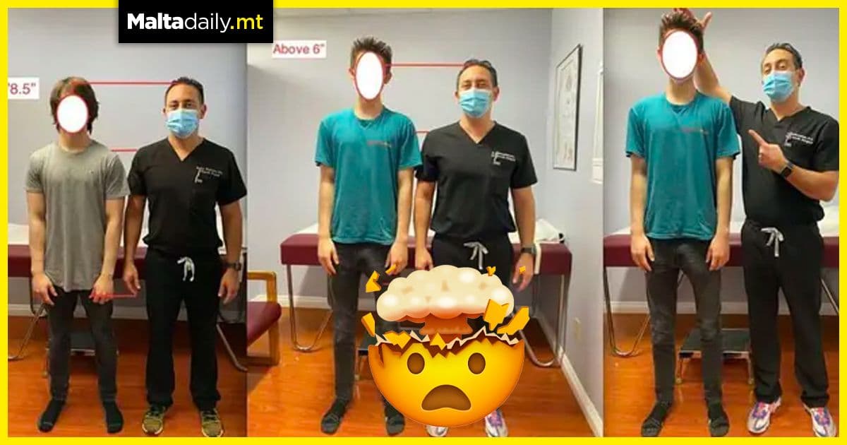 Doctor claims he can make his patients 5.6 inches taller through surgery