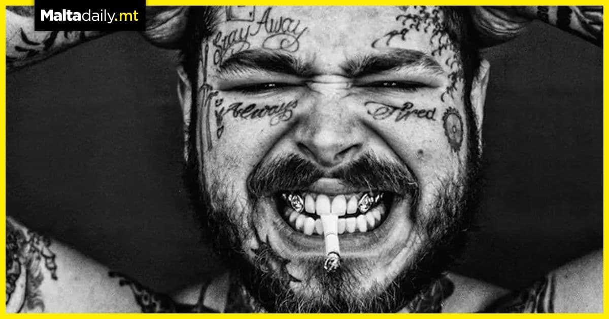 Post Malone spends $1.6 million to get diamond teeth
