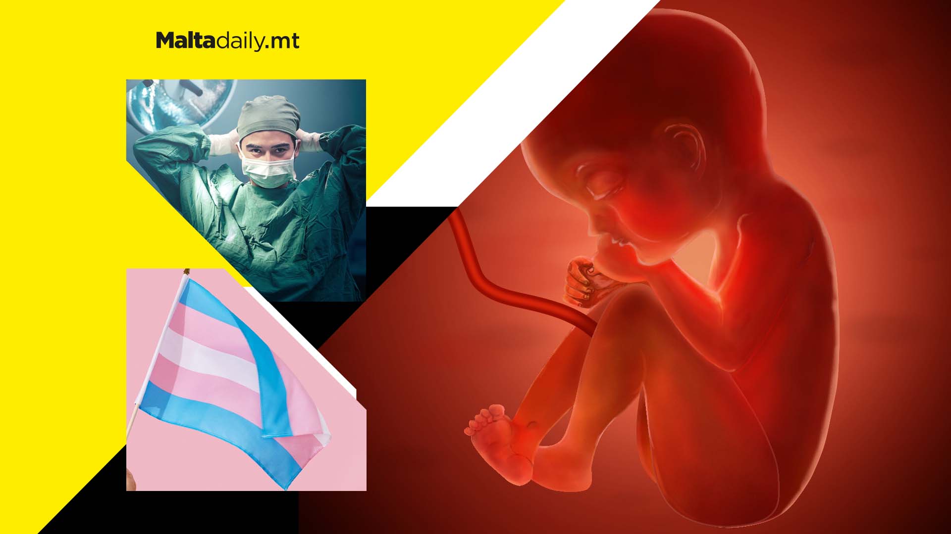 Surgeon will try transplanting womb into trans woman to help her get pregnant