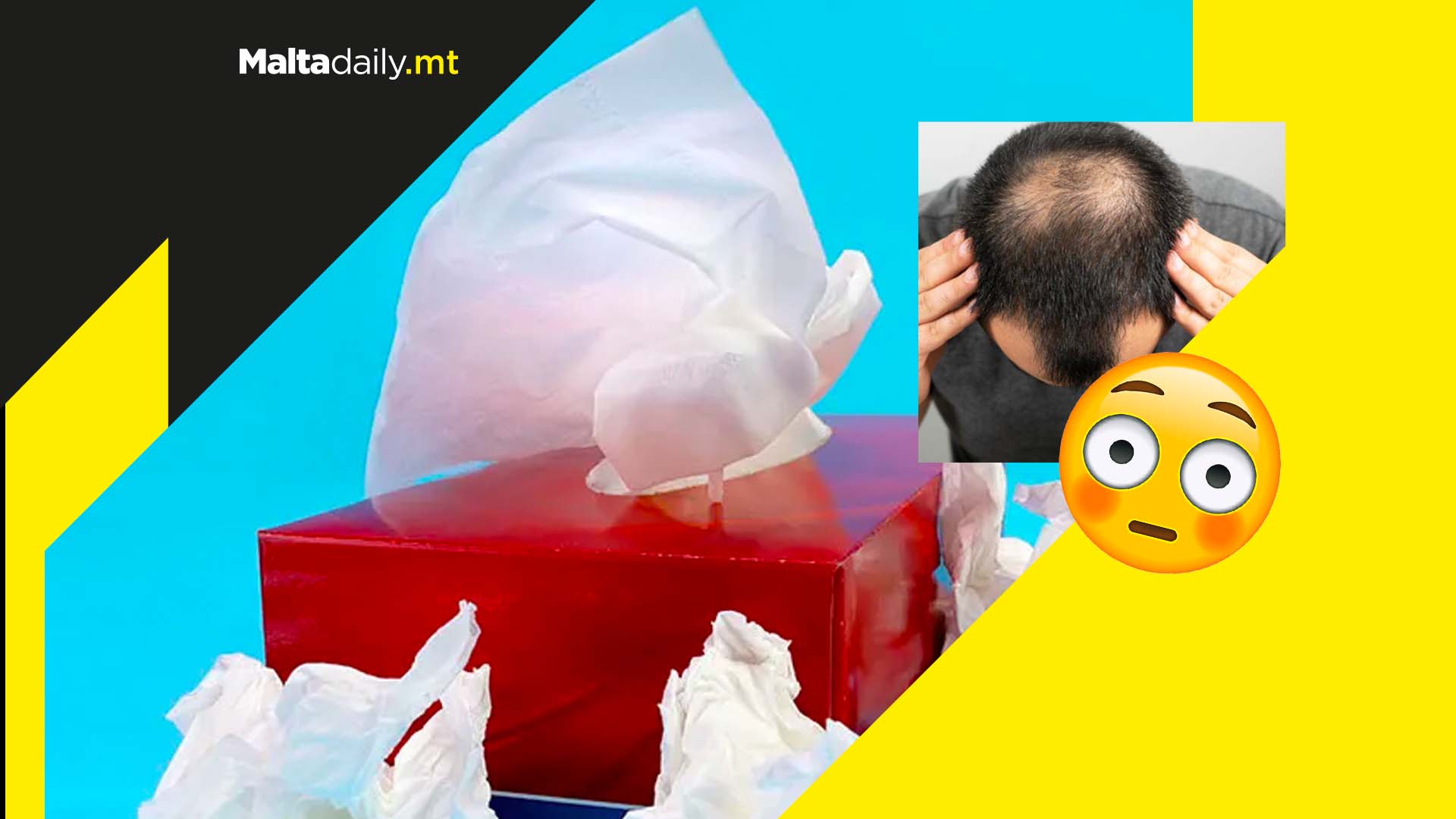 Too much masturbation can lead to hair loss says top surgeon