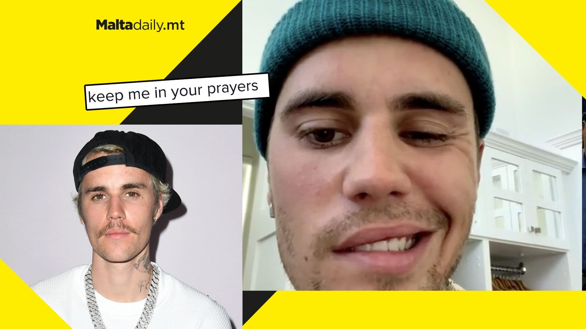 Justin Bieber reveals face is paralysed after having to cancel shows