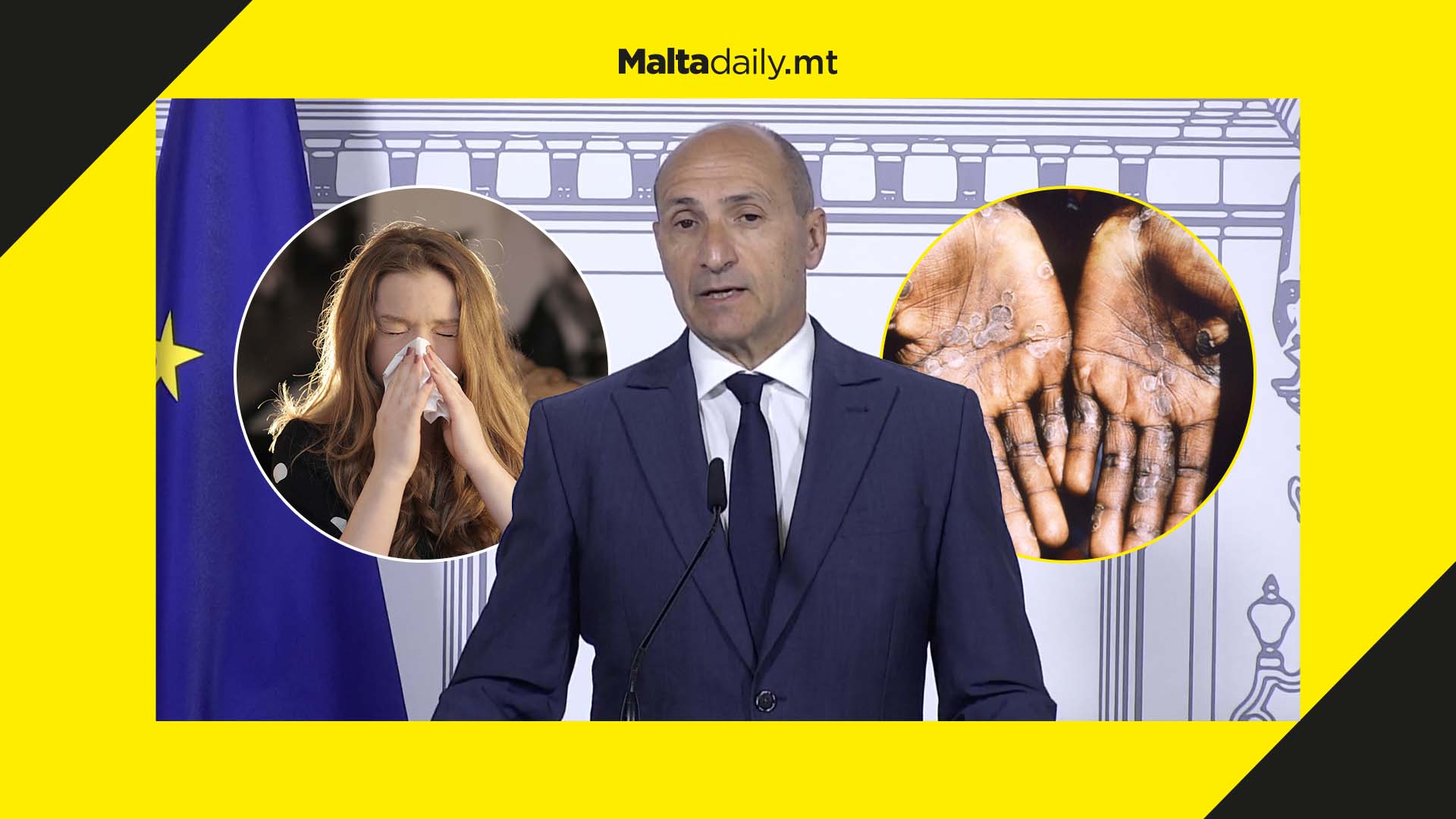 No Monkeypox in Malta & COVID under control, says Chris Fearne