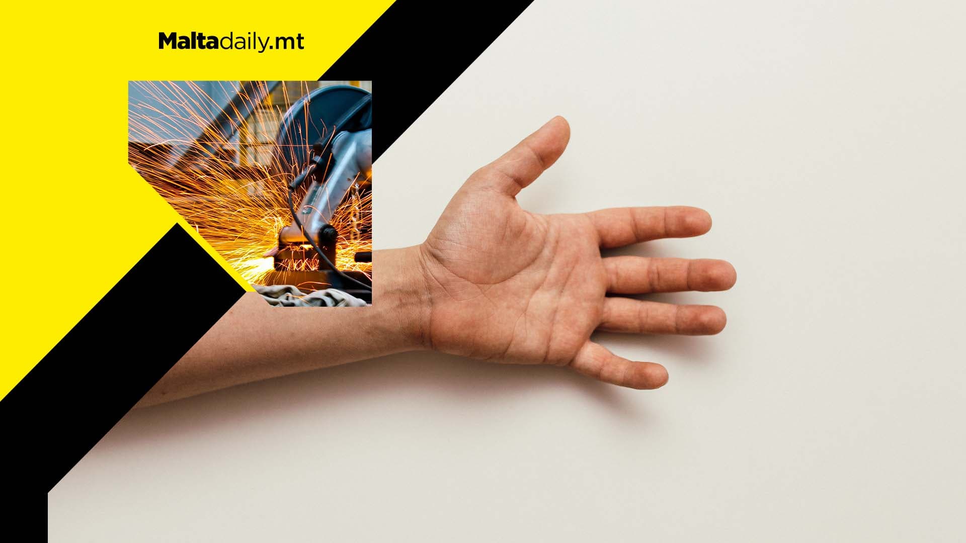 Worker compensated €81,000 after losing finger in factory incident