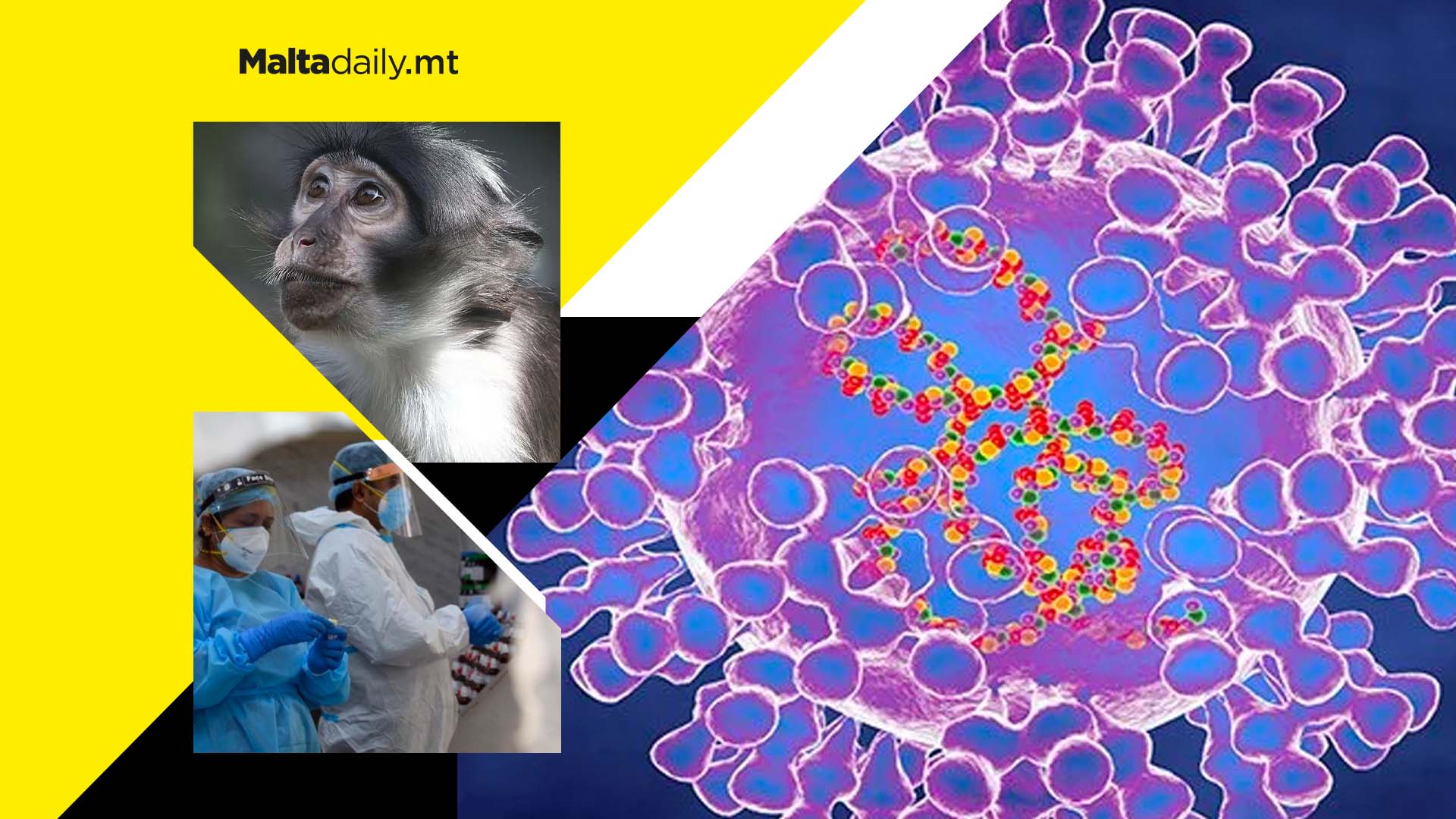 Europe and North America detect rare monkeypox outbreaks