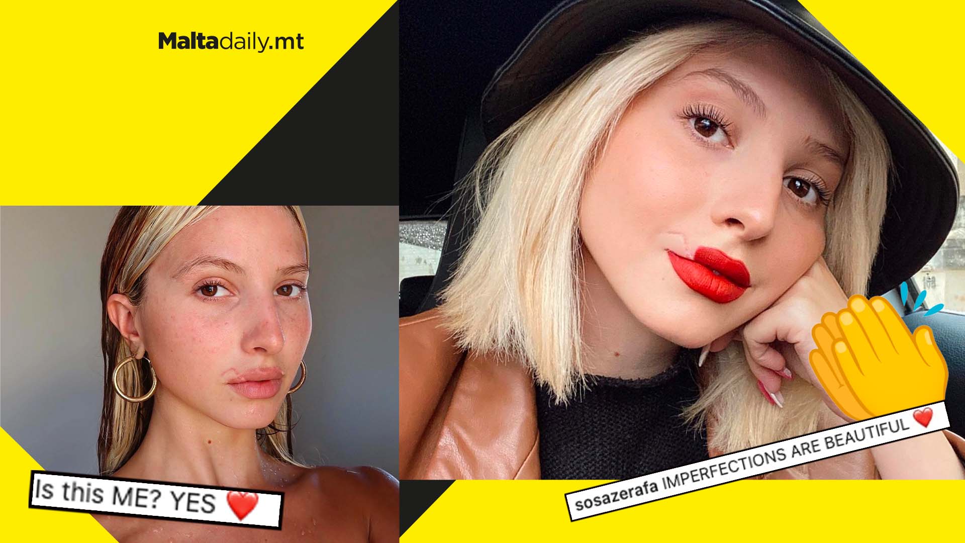 Imperfections are beautiful: Sarah Zerafa speaks out