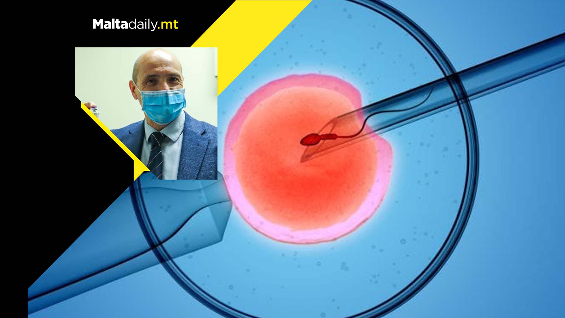 Malta 15th best out of 43 countries for IVF treatment policies