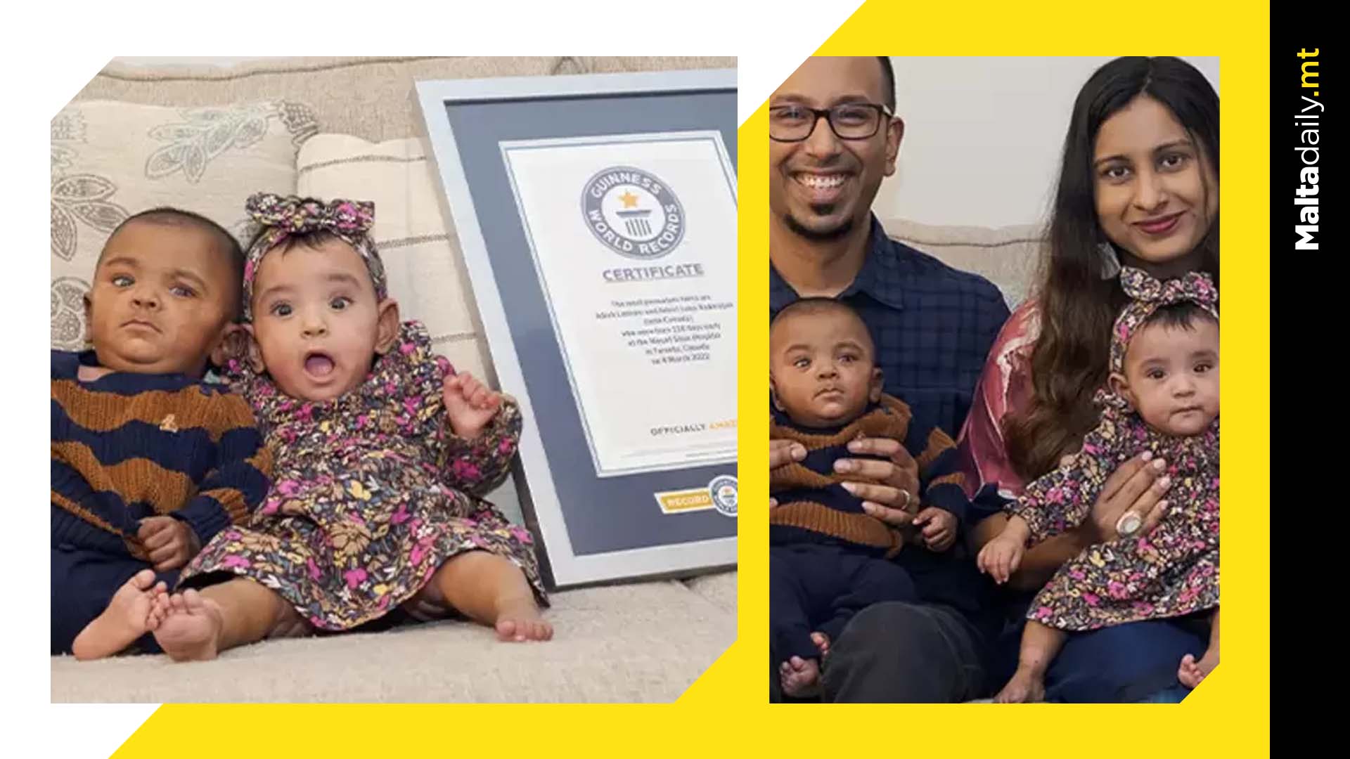 World’s most premature twins celebrate 1st birthday