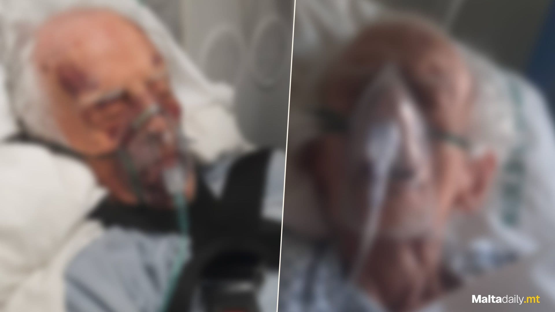 Elderly Man Reportedly Assaulted By Care Home Roommate