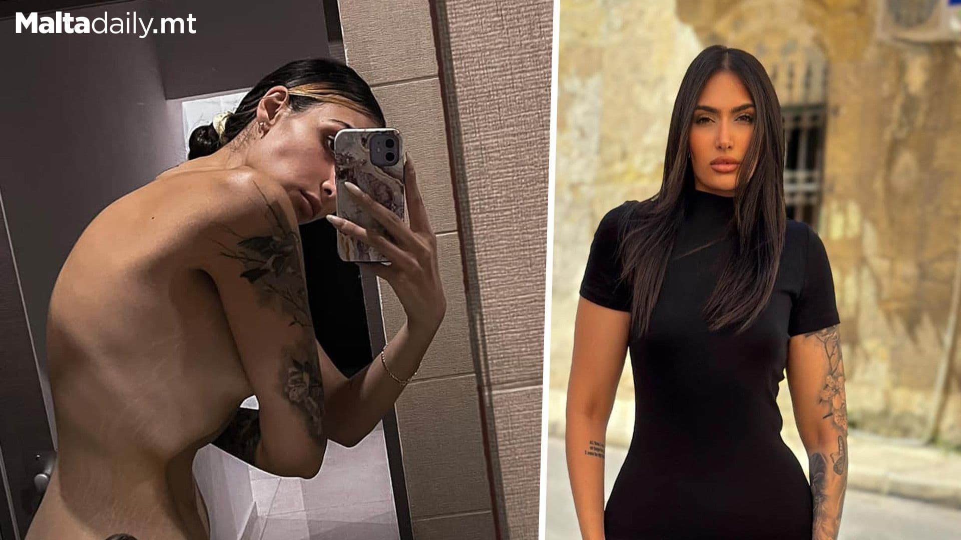 Miss Mosta Edera Fenech Raises Awareness For Anorexia