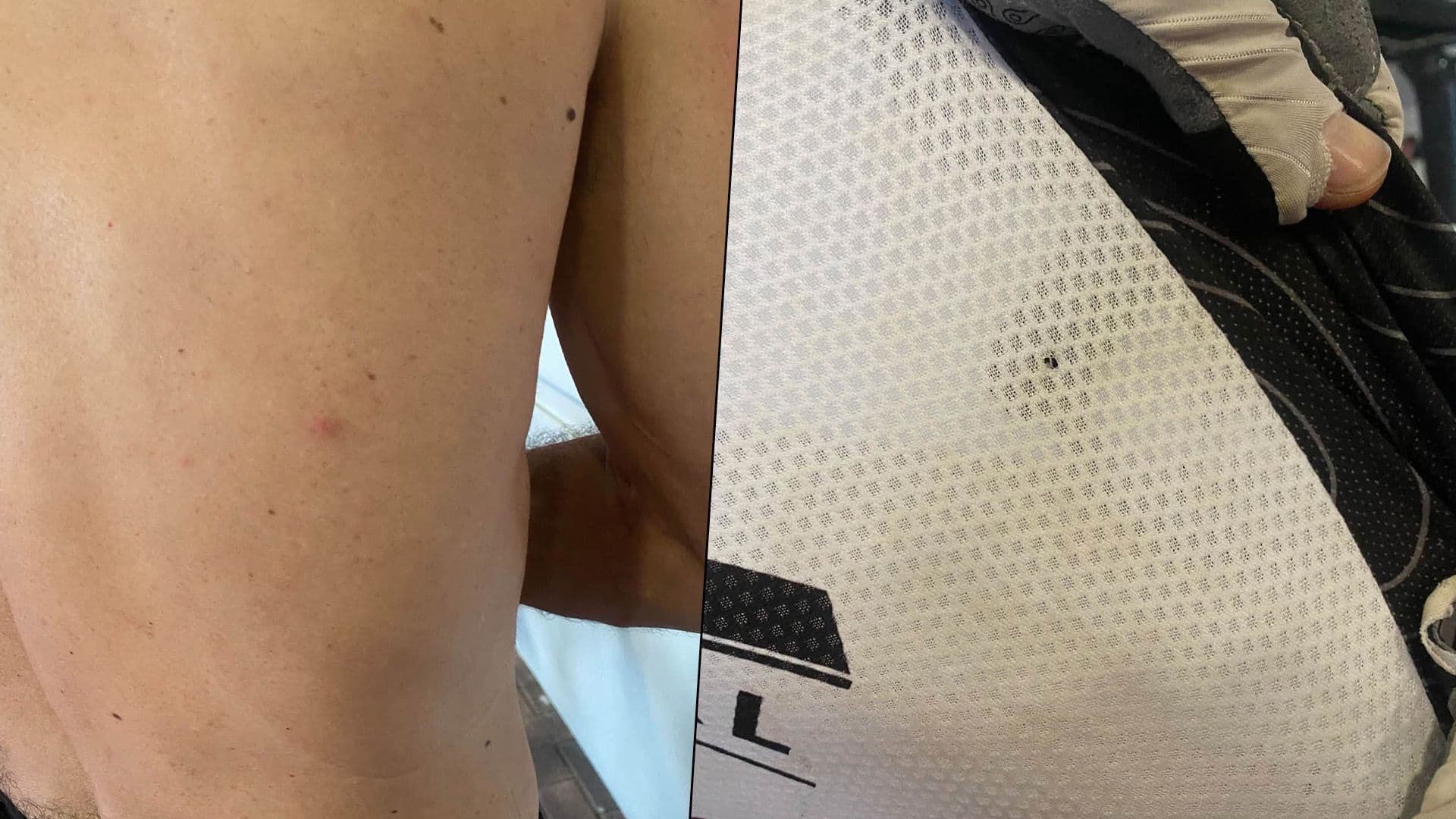 Local Biker Reports Being Hit By Hunter Gun Pellets At Victoria Lines
