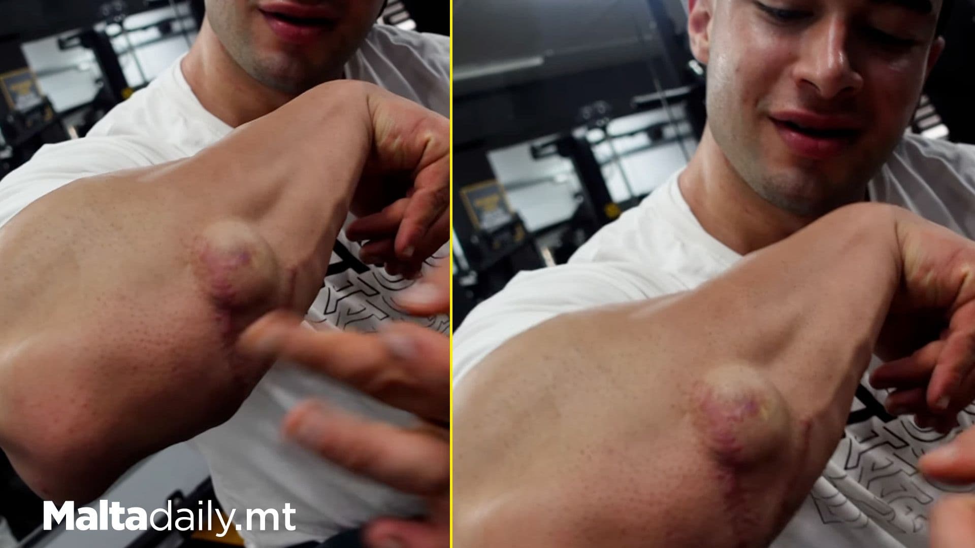 Maltese Bodybuilder Features On LadBible Over ‘Extra Muscle’