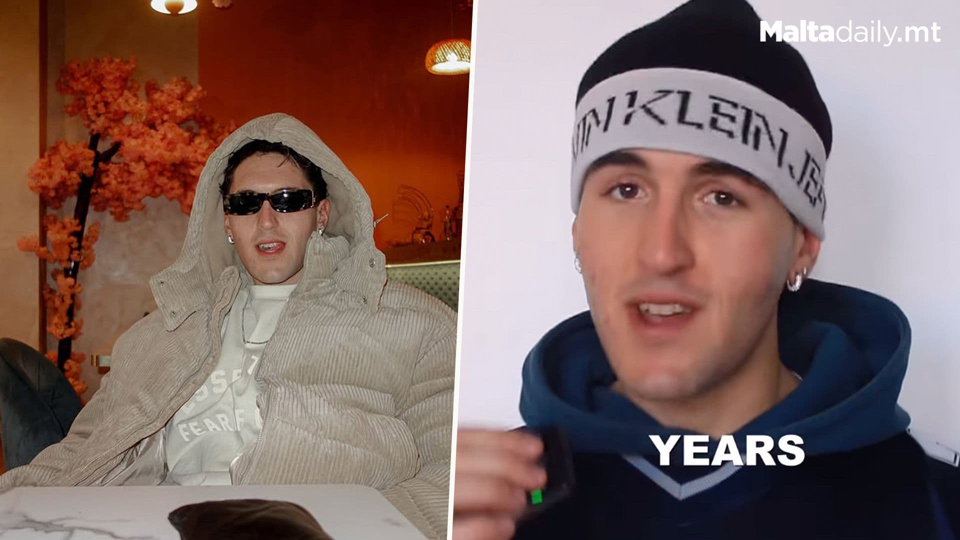 Dale Mallia Opens Up About Skin Insecurity