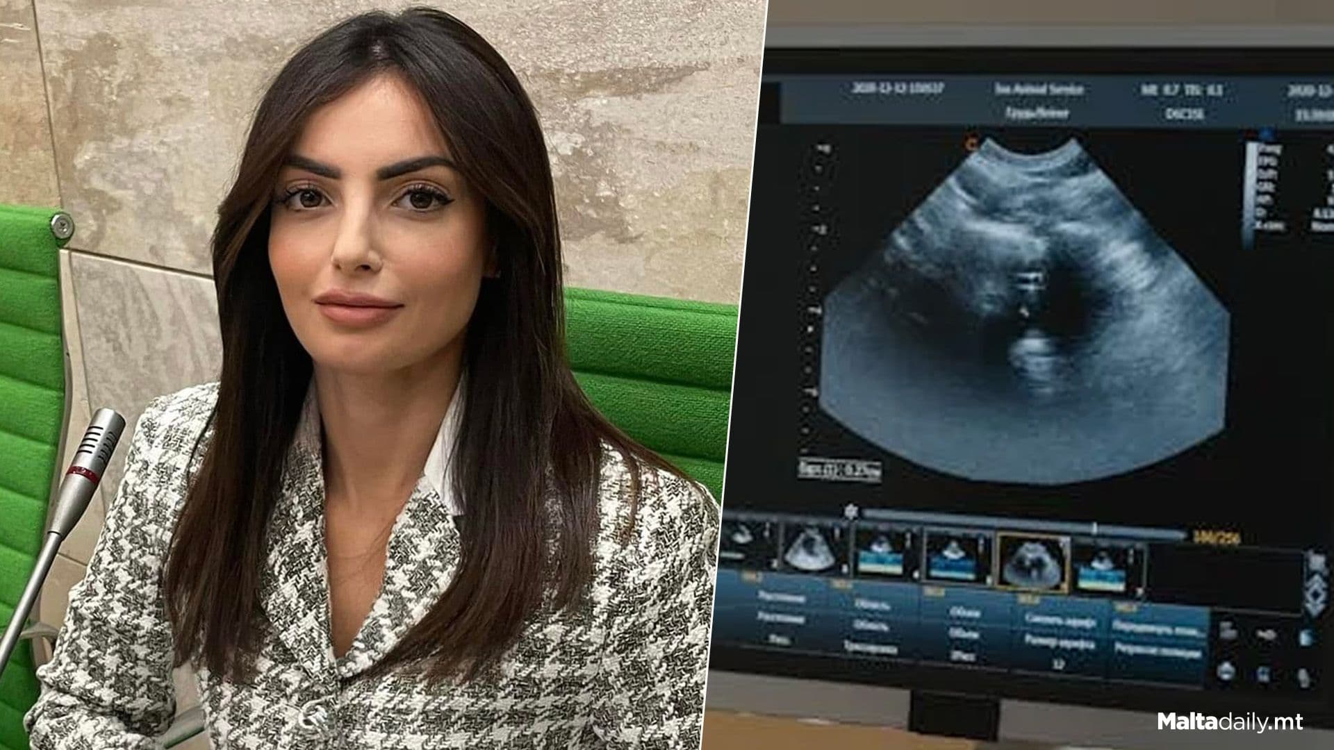 Protect Women’s Privacy In Miscarriage Leave Proposals, Says MP