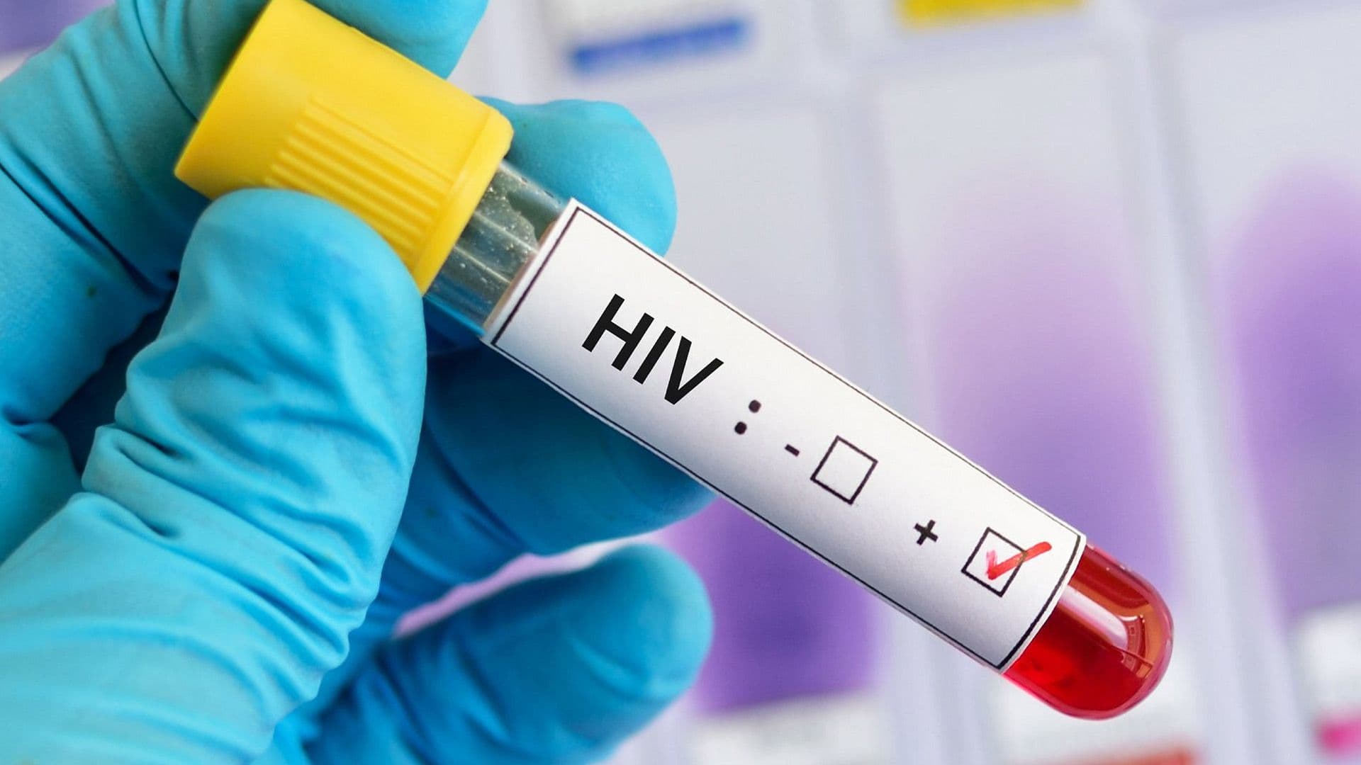 HIV Diagnoses Among Maltese Doubled Over 30 Years, Says Dr