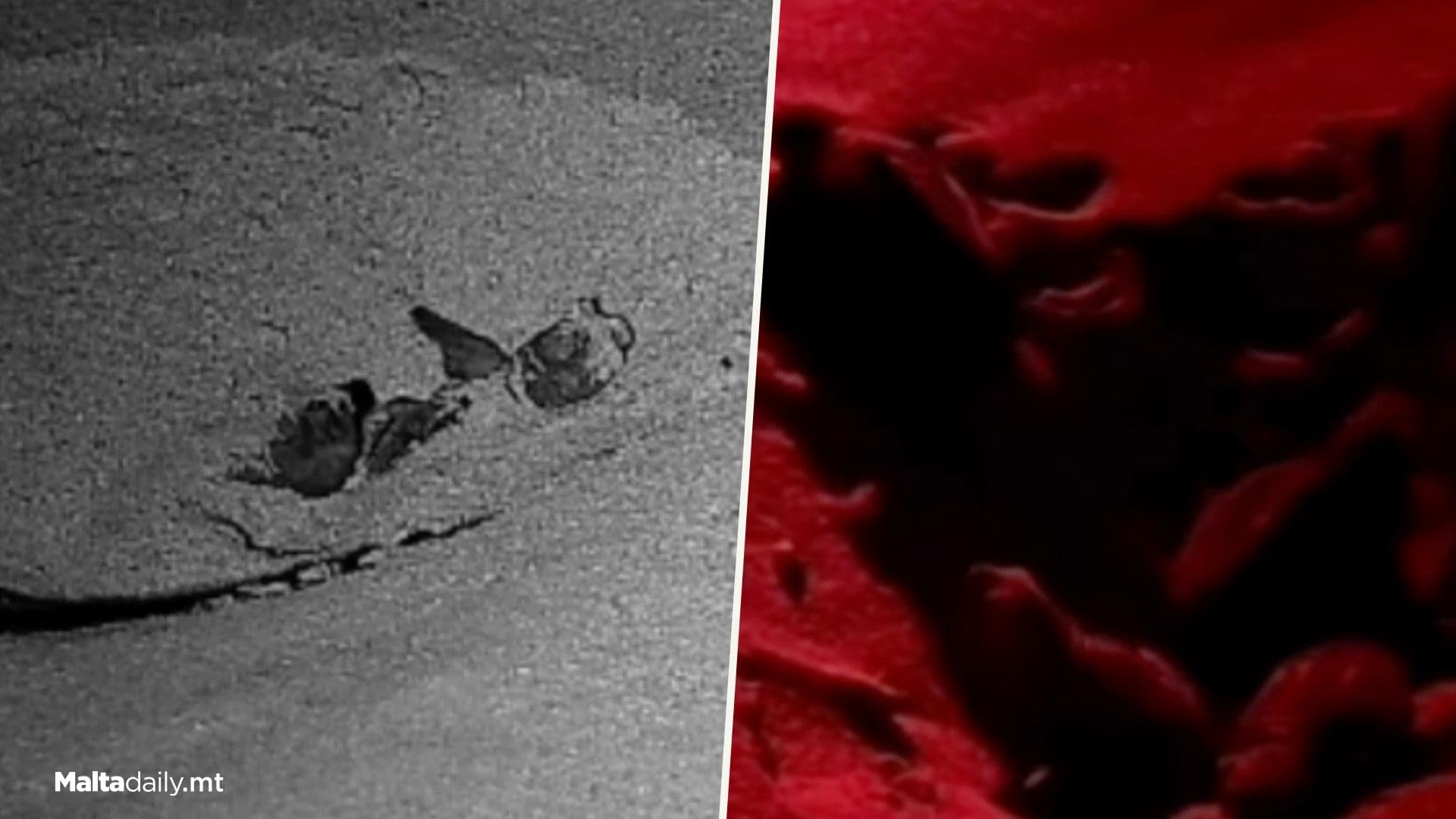 More Turtles! Nest 3 In Gozo Starts To Hatch!