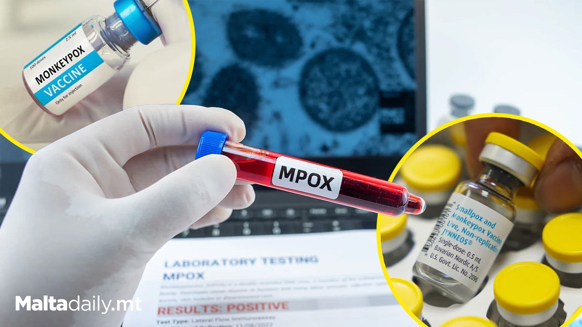 Malta and EU Nations Donate Half a Million Mpox Vaccine Doses To Africa