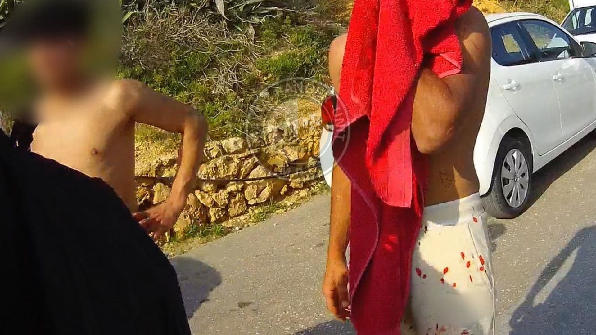 Young Person Injured After Fight In Golden Bay