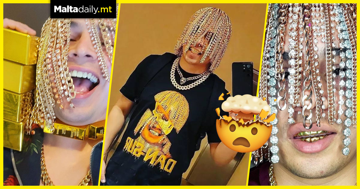 This rapper went viral after surgically implanting gold chains into his scalp