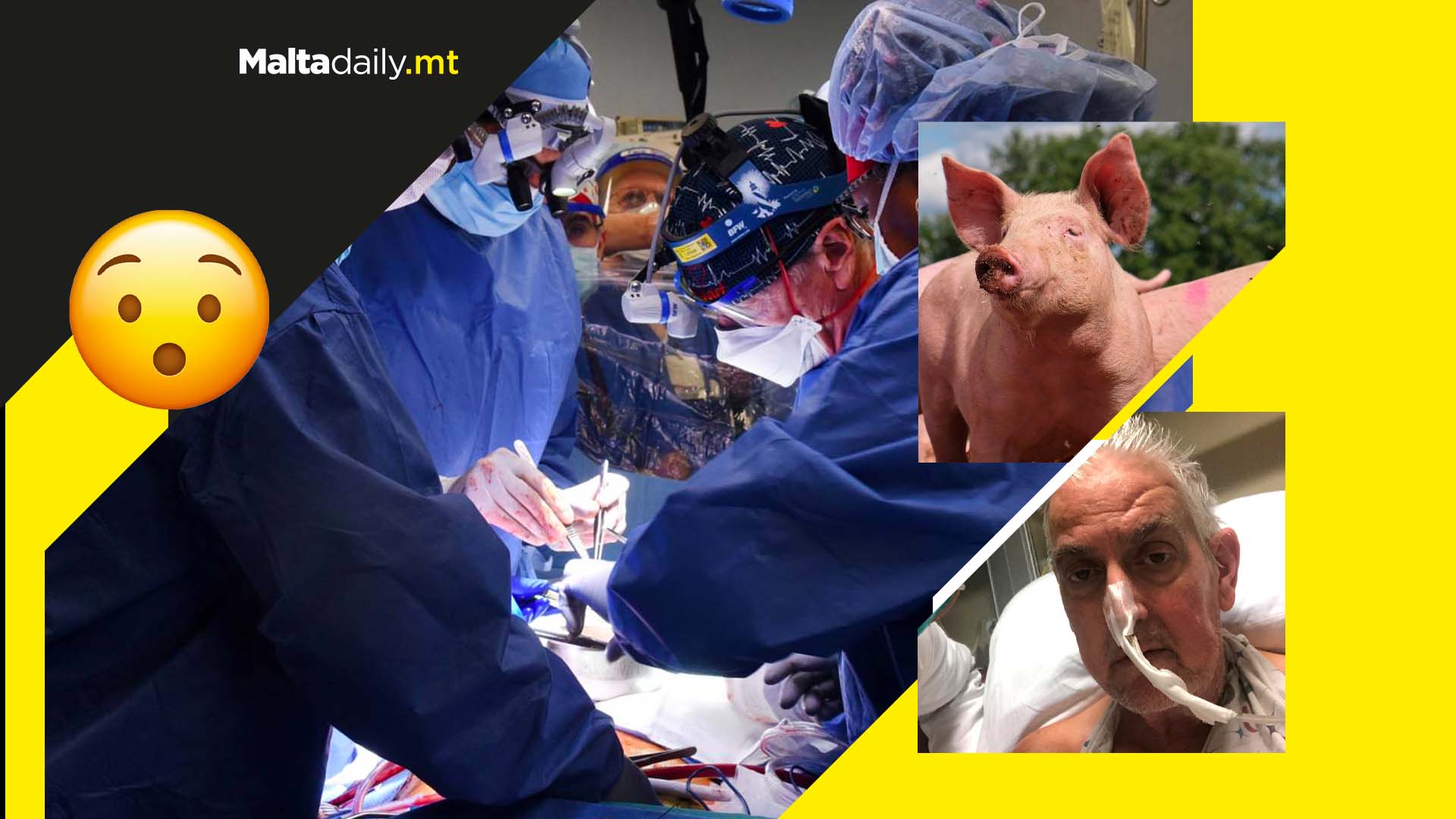 First ever pig heart transplanted into human patient a medical first
