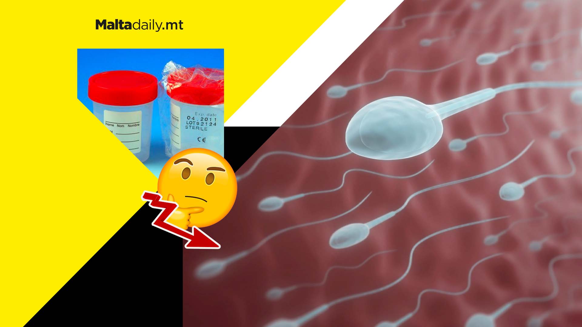 Alleged global sperm decline furthers debate over male fertility