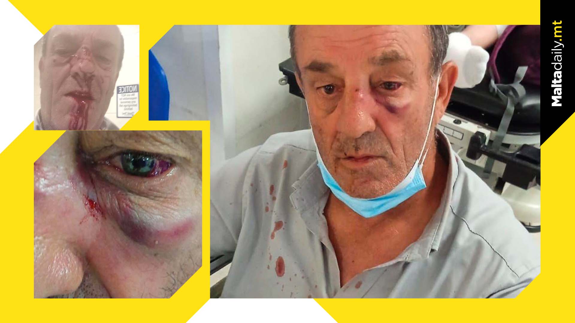 Outrage After Taxi Driver Assaulted Brutally By Y-Plate Driver