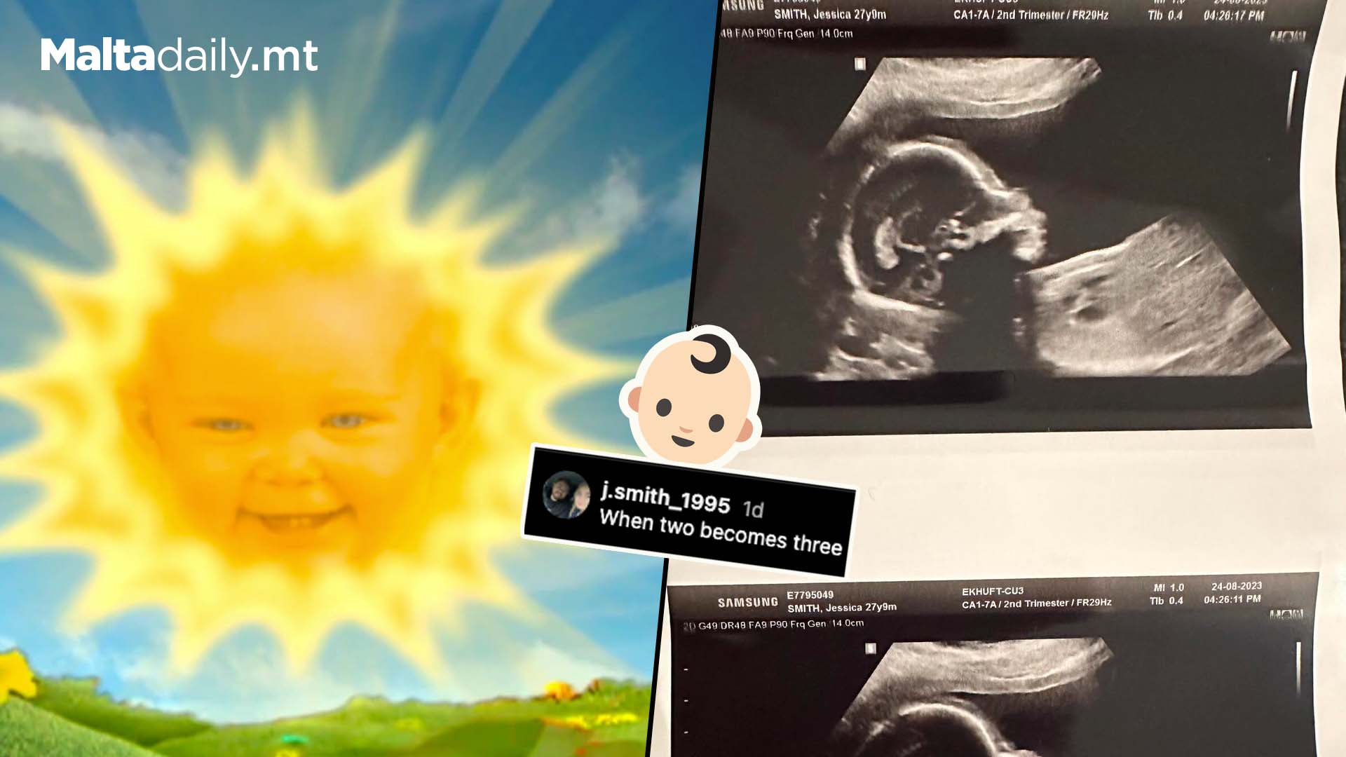 Teletubbies Sun Is Now Pregnant With Her Own Baby