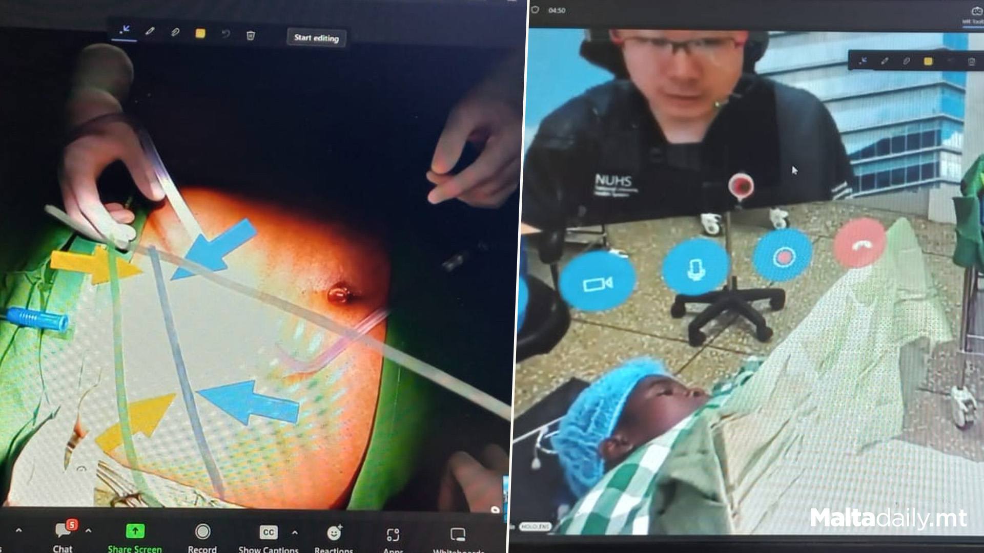 Augmented Reality Surgery at HopeXchange Medical Centre, Ghana
